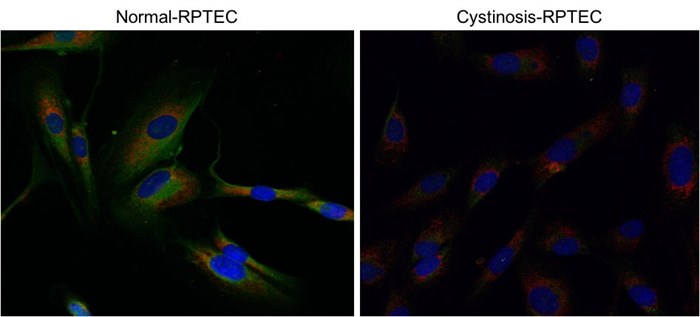 Cystinosis Research A Rare Autosomal Figure 2