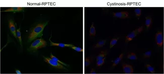 cystinosis-research-a-rare-autosomal